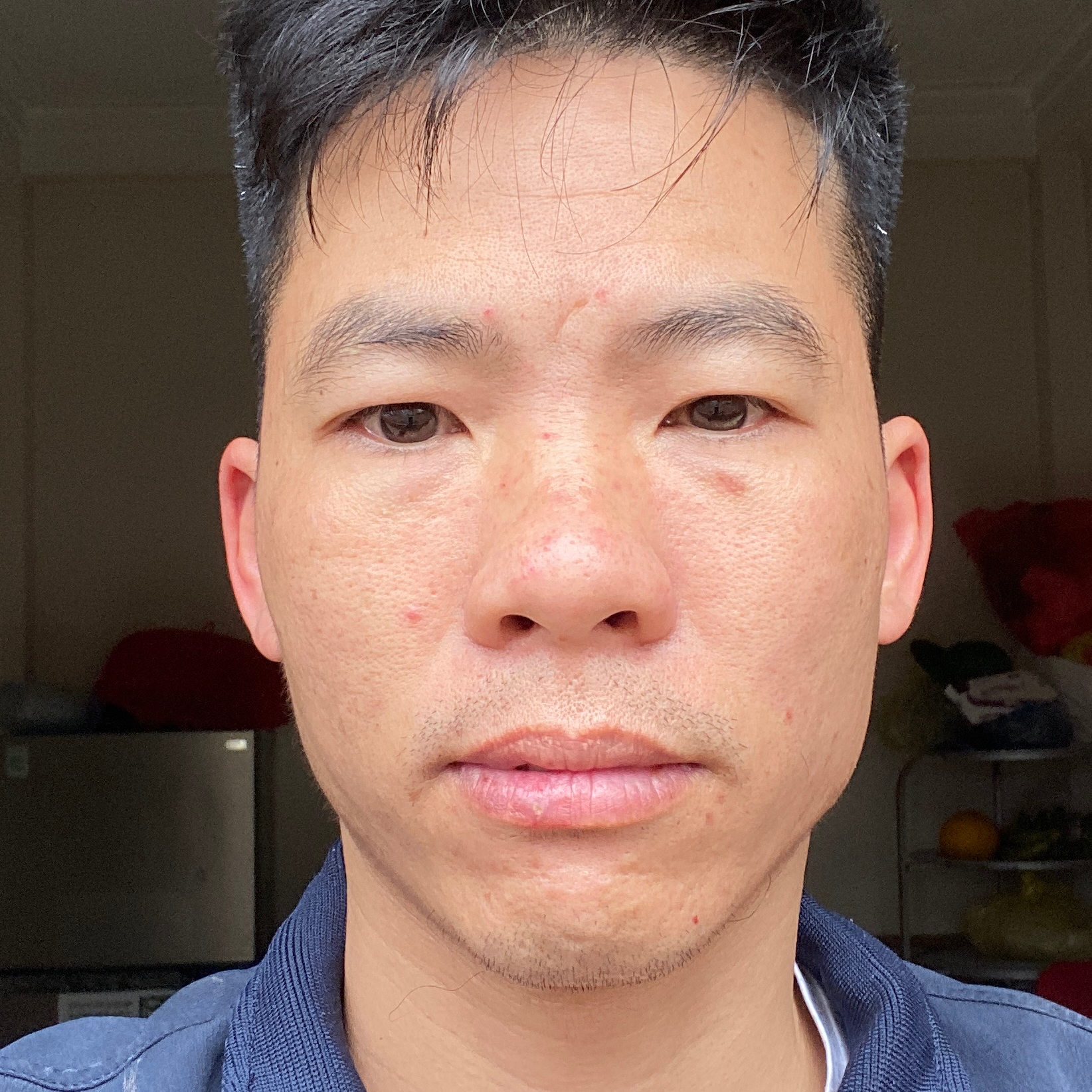 Avar Ứng viên