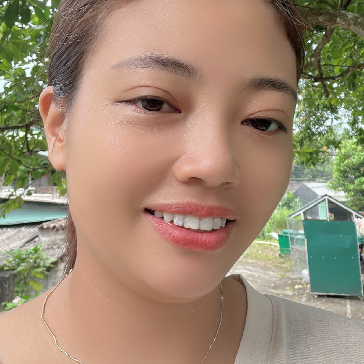 Avar Ứng viên