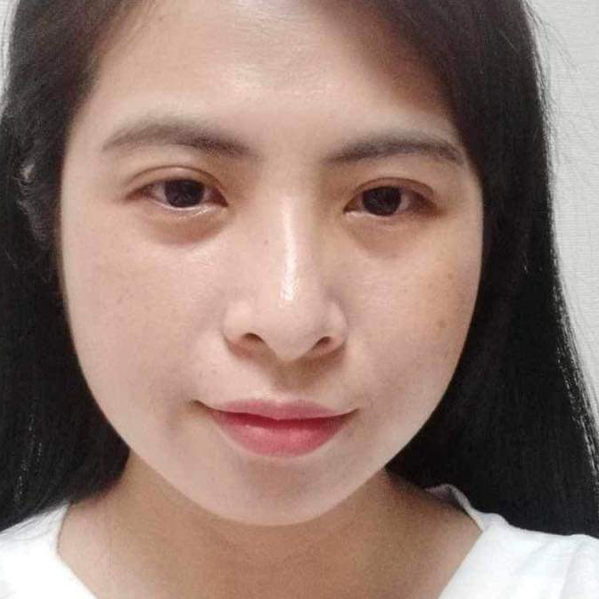 Avar Ứng viên